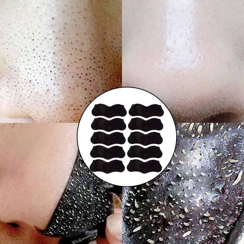 100pcs Nose Blackhead Remover Mask Deep Cleansing Black dots Pore Clean Strips