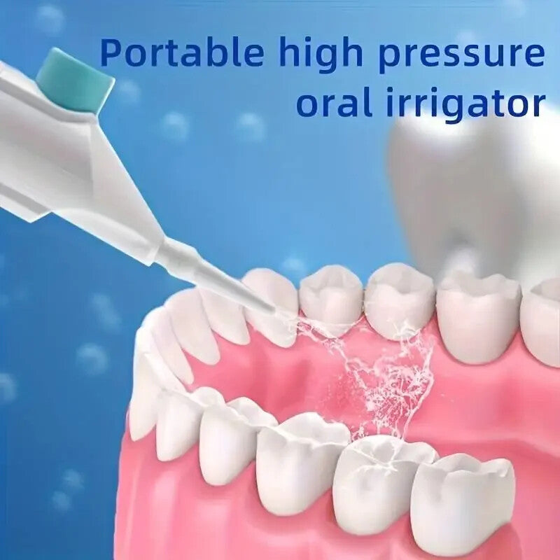 Portable High Pressure Oral Irrigator - Manual Teeth Cleaner, Water Dental Floss