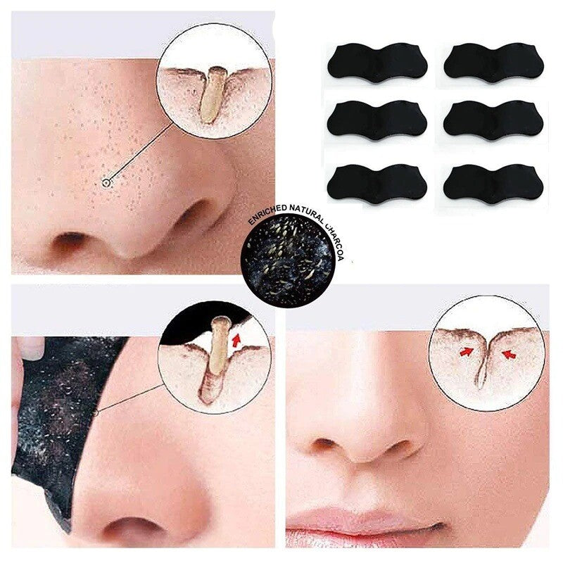 100pcs Nose Blackhead Remover Mask Deep Cleansing Black dots Pore Clean Strips