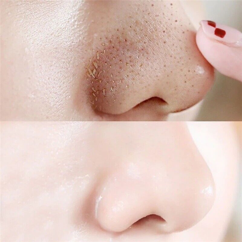 100pcs Nose Blackhead Remover Mask Deep Cleansing Black dots Pore Clean Strips