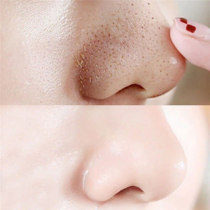100pcs Nose Blackhead Remover Mask Deep Cleansing Black dots Pore Clean Strips